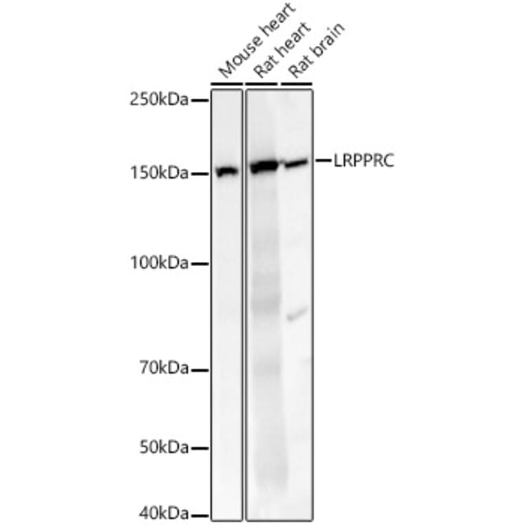 Western Blot - Anti-LRPPRC/GP130 Antibody (A14432) - Antibodies.com