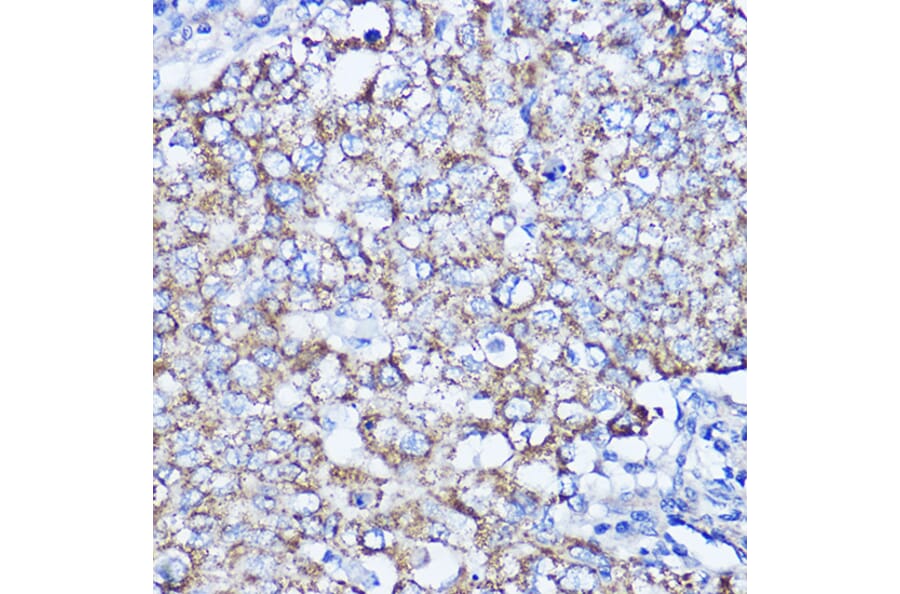 Immunohistochemistry - Anti-LRPPRC/GP130 Antibody (A14432) - Antibodies.com