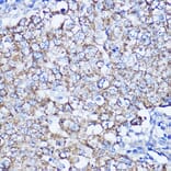 Immunohistochemistry - Anti-LRPPRC/GP130 Antibody (A14432) - Antibodies.com
