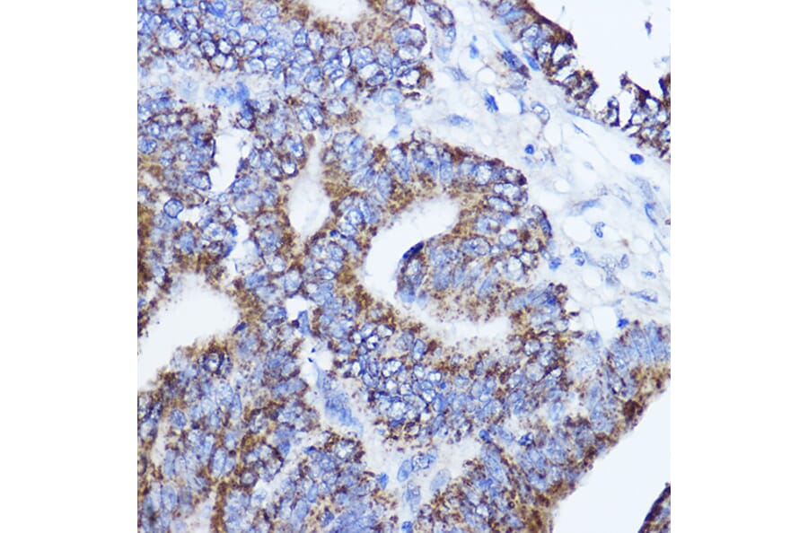 Immunohistochemistry - Anti-LRPPRC/GP130 Antibody (A14432) - Antibodies.com