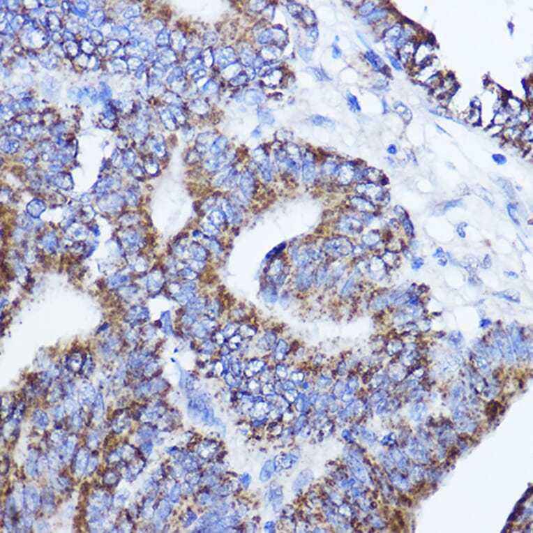 Immunohistochemistry - Anti-LRPPRC/GP130 Antibody (A14432) - Antibodies.com