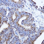 Immunohistochemistry - Anti-LRPPRC/GP130 Antibody (A14432) - Antibodies.com