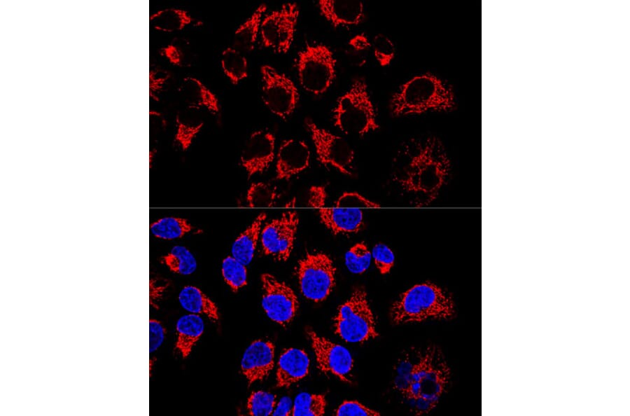 Immunofluorescence - Anti-LRPPRC/GP130 Antibody (A14432) - Antibodies.com