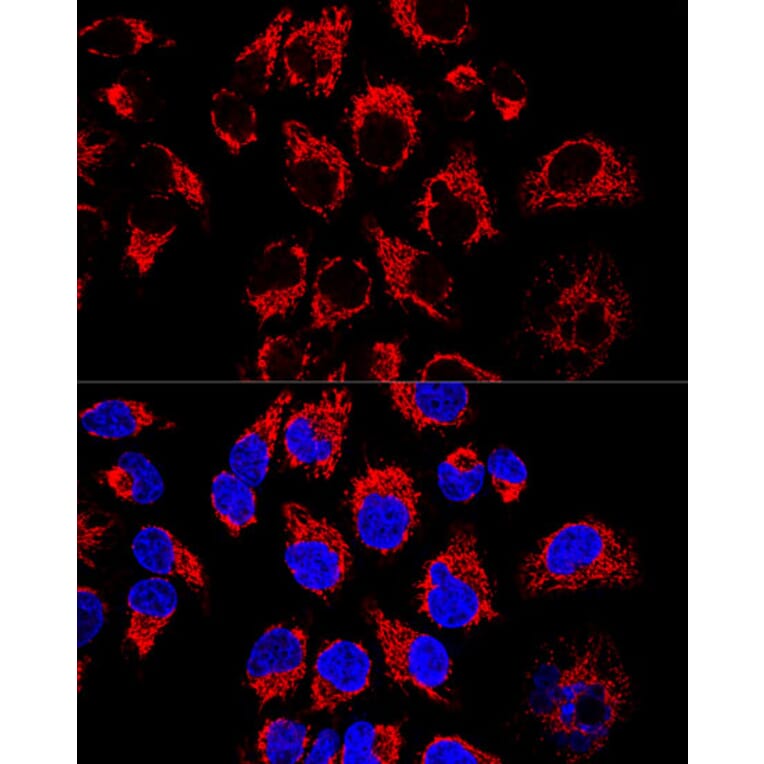 Immunofluorescence - Anti-LRPPRC/GP130 Antibody (A14432) - Antibodies.com