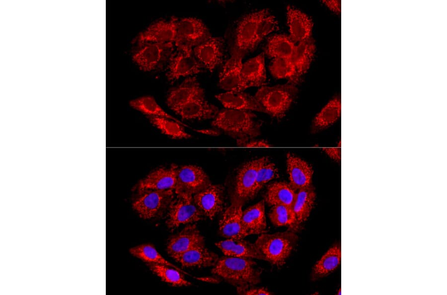 Immunofluorescence - Anti-LRPPRC/GP130 Antibody (A14432) - Antibodies.com