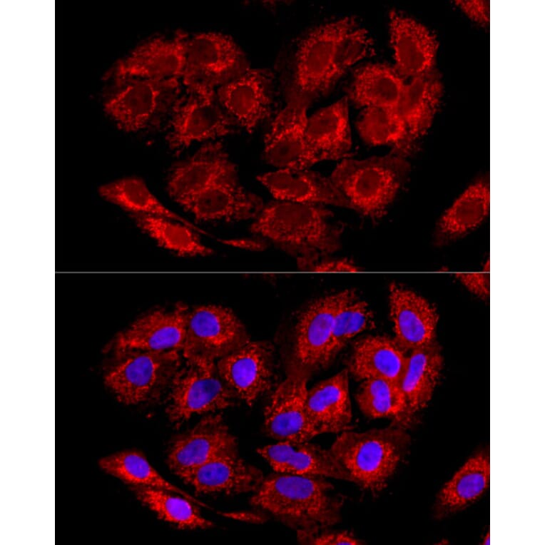 Immunofluorescence - Anti-LRPPRC/GP130 Antibody (A14432) - Antibodies.com