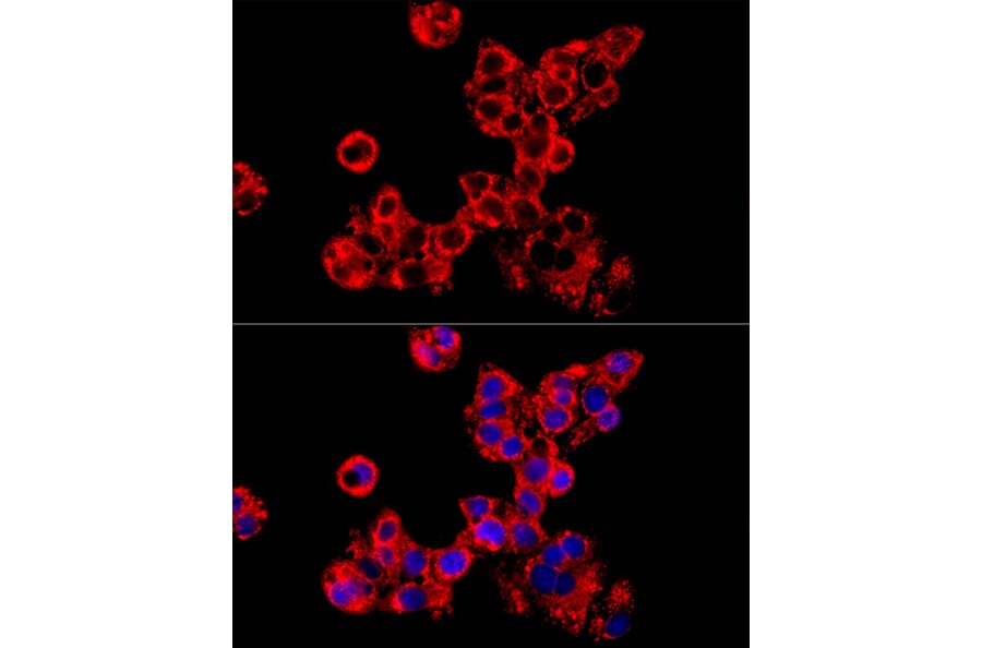 Immunofluorescence - Anti-LRPPRC/GP130 Antibody (A14432) - Antibodies.com