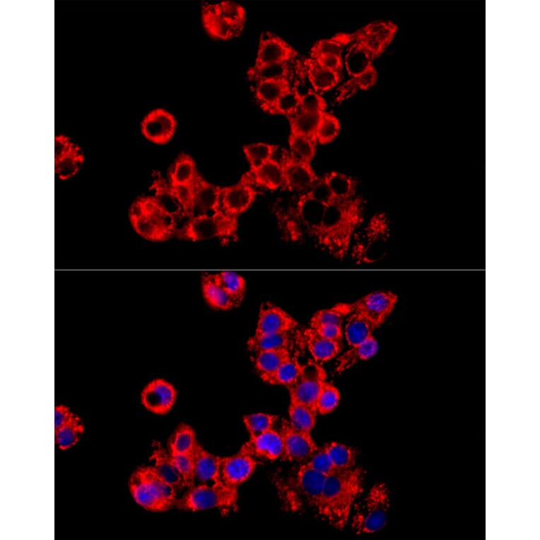 Immunofluorescence - Anti-LRPPRC/GP130 Antibody (A14432) - Antibodies.com