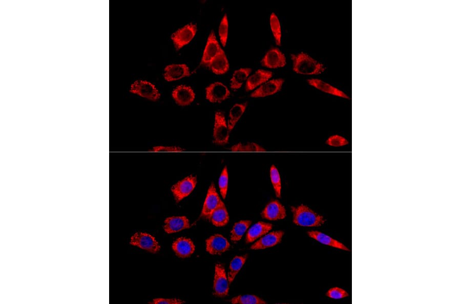Immunofluorescence - Anti-LRPPRC/GP130 Antibody (A14432) - Antibodies.com
