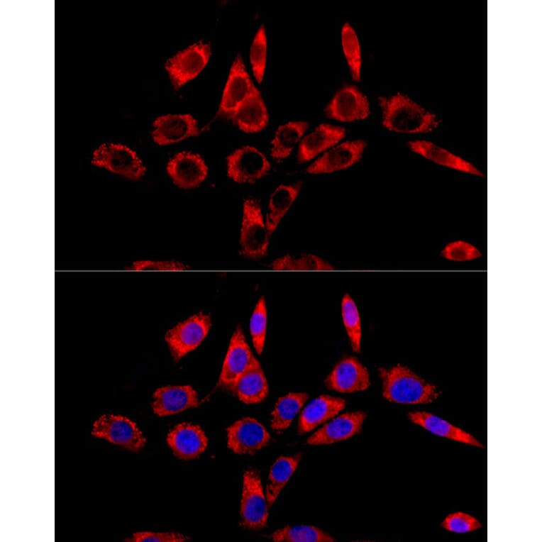 Immunofluorescence - Anti-LRPPRC/GP130 Antibody (A14432) - Antibodies.com