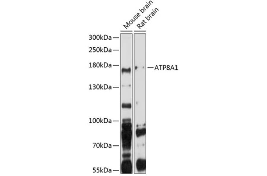 Western Blot - Anti-ATP8A1 Antibody (A3369) - Antibodies.com