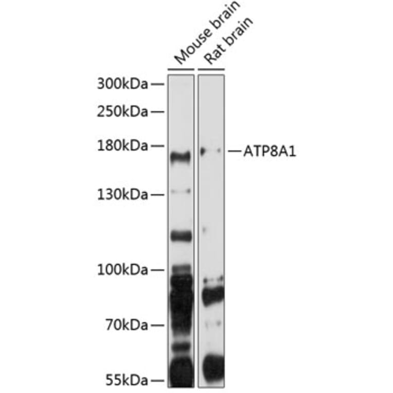 Western Blot - Anti-ATP8A1 Antibody (A3369) - Antibodies.com