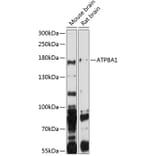 Western Blot - Anti-ATP8A1 Antibody (A3369) - Antibodies.com