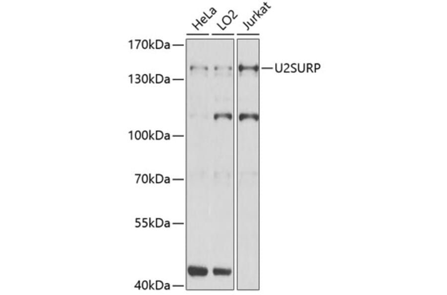Western Blot - Anti-SR140 Antibody (A14434) - Antibodies.com