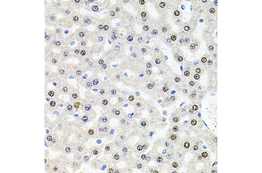 Immunohistochemistry - Anti-SR140 Antibody (A14434) - Antibodies.com