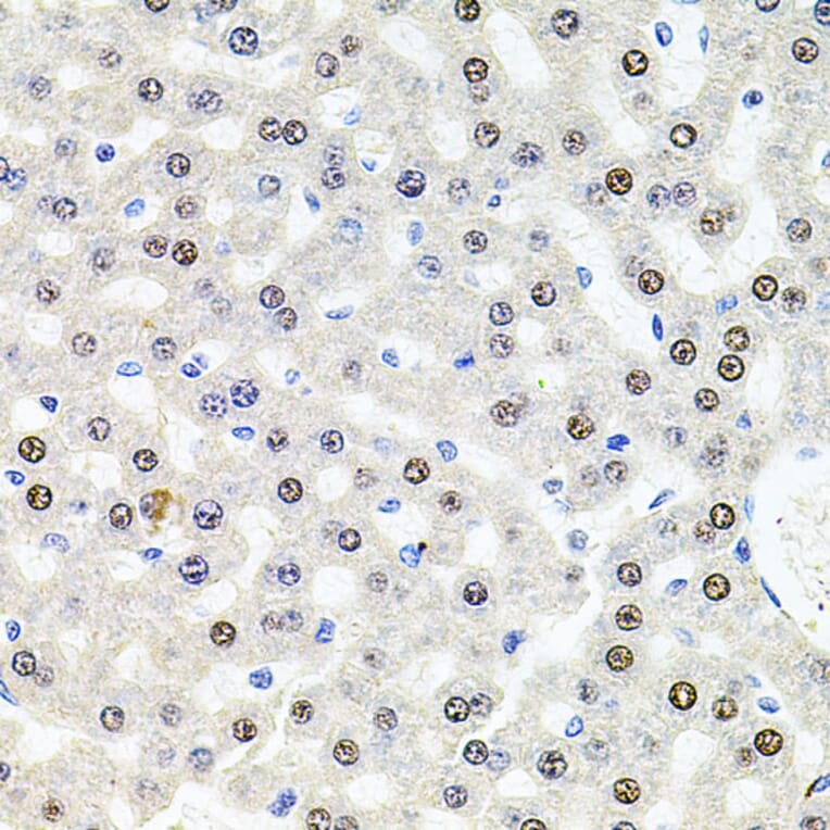 Immunohistochemistry - Anti-SR140 Antibody (A14434) - Antibodies.com