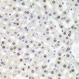 Immunohistochemistry - Anti-SR140 Antibody (A14434) - Antibodies.com