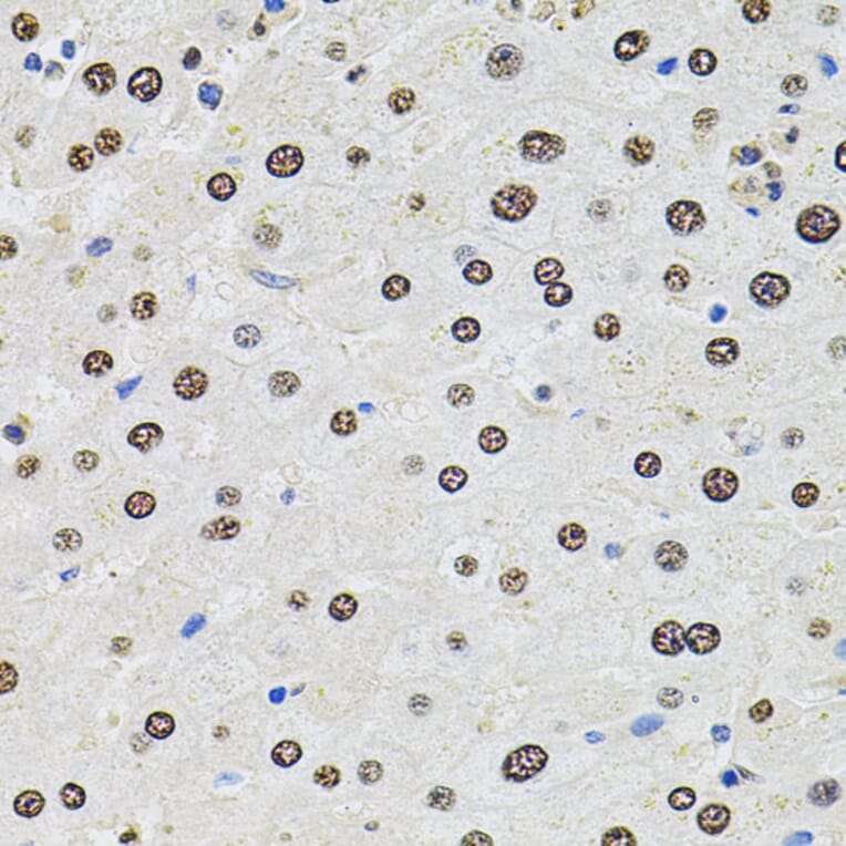 Immunohistochemistry - Anti-SR140 Antibody (A14434) - Antibodies.com