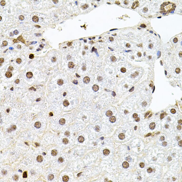 Immunohistochemistry - Anti-SR140 Antibody (A14434) - Antibodies.com