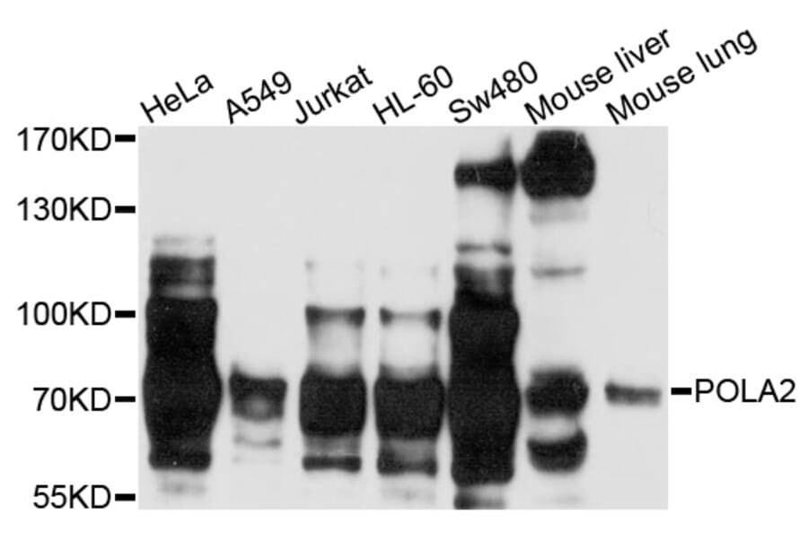 Western Blot - Anti-POLA2 Antibody (A3400) - Antibodies.com