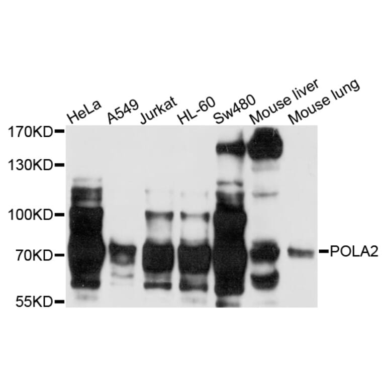 Western Blot - Anti-POLA2 Antibody (A3400) - Antibodies.com
