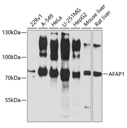 Western Blot - Anti-AFAP Antibody (A14437) - Antibodies.com