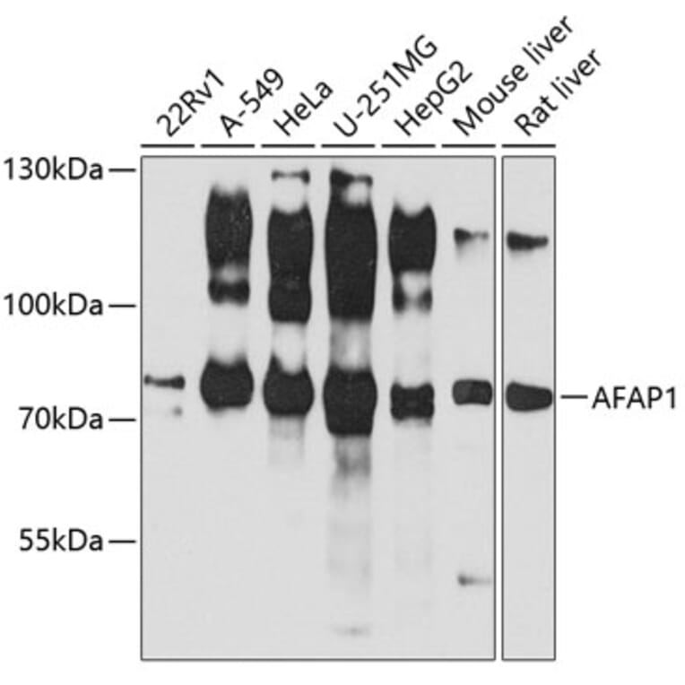 Western Blot - Anti-AFAP Antibody (A14437) - Antibodies.com