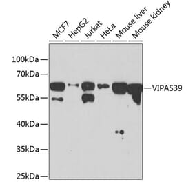 Western Blot - Anti-C14orf133 Antibody (A14438) - Antibodies.com