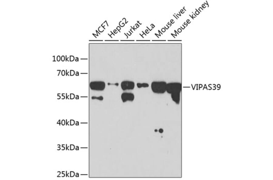 Western Blot - Anti-C14orf133 Antibody (A14438) - Antibodies.com
