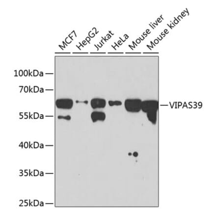Western Blot - Anti-C14orf133 Antibody (A14438) - Antibodies.com