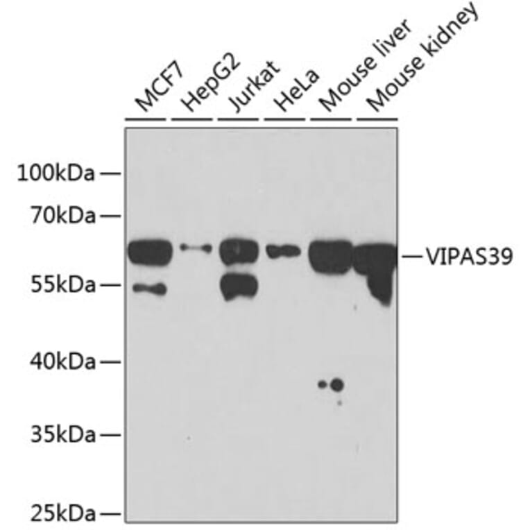 Western Blot - Anti-C14orf133 Antibody (A14438) - Antibodies.com