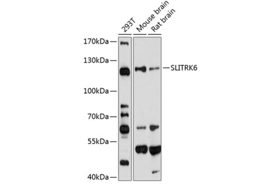 Western Blot - Anti-SLITRK6 Antibody (A14439) - Antibodies.com