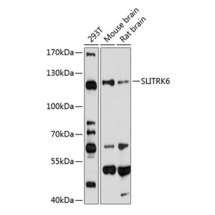 Western Blot - Anti-SLITRK6 Antibody (A14439) - Antibodies.com