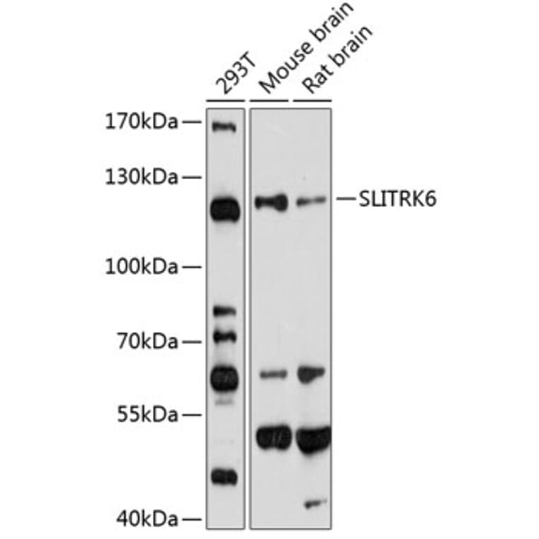 Western Blot - Anti-SLITRK6 Antibody (A14439) - Antibodies.com