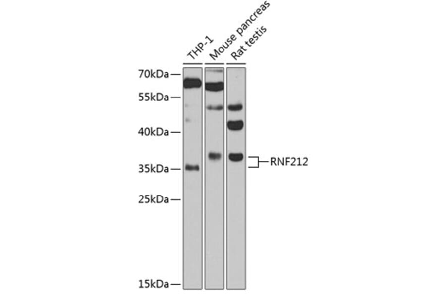 Western Blot - Anti-RNF212 Antibody (A3569) - Antibodies.com