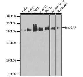 Western Blot - Anti-RhoGAP Antibody (A14442) - Antibodies.com