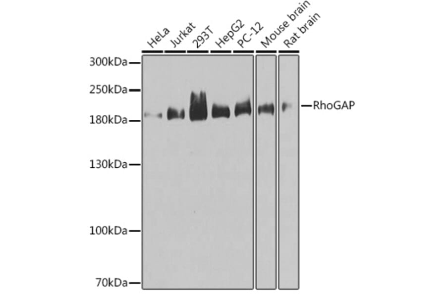 Western Blot - Anti-RhoGAP Antibody (A14442) - Antibodies.com