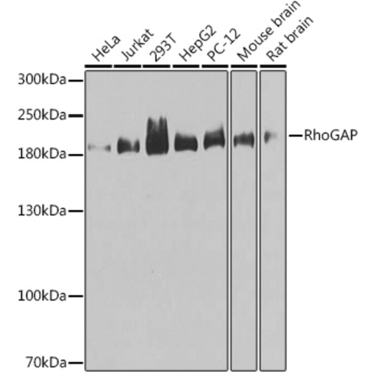Western Blot - Anti-RhoGAP Antibody (A14442) - Antibodies.com