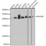 Western Blot - Anti-RhoGAP Antibody (A14442) - Antibodies.com
