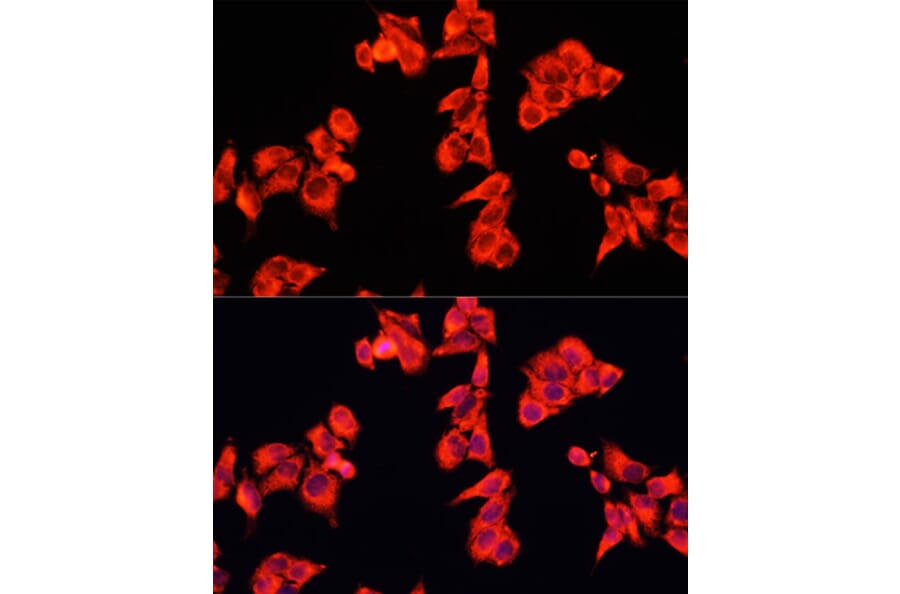 Immunofluorescence - Anti-RhoGAP Antibody (A14442) - Antibodies.com