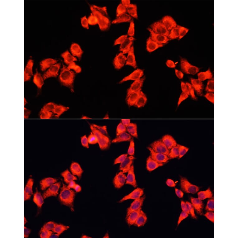 Immunofluorescence - Anti-RhoGAP Antibody (A14442) - Antibodies.com