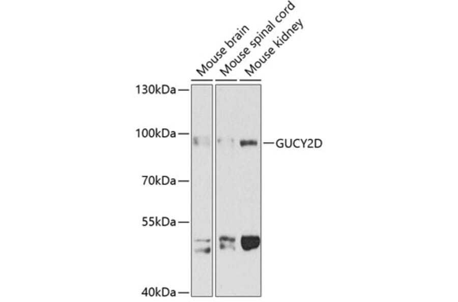 Western Blot - Anti-GUCY2D Antibody (A14443) - Antibodies.com