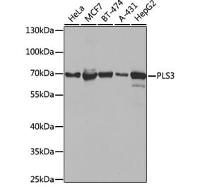 Western Blot - Anti-PLS3 Antibody (A14445) - Antibodies.com