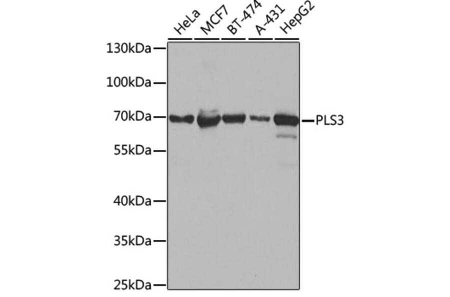 Western Blot - Anti-PLS3 Antibody (A14445) - Antibodies.com