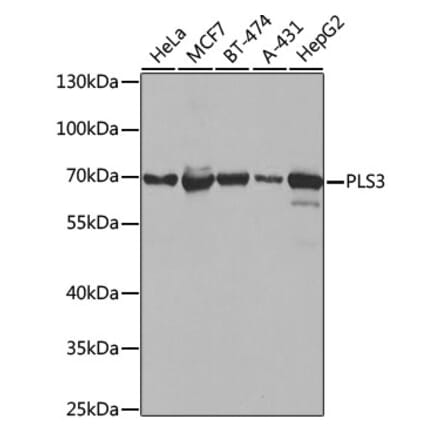 Western Blot - Anti-PLS3 Antibody (A14445) - Antibodies.com