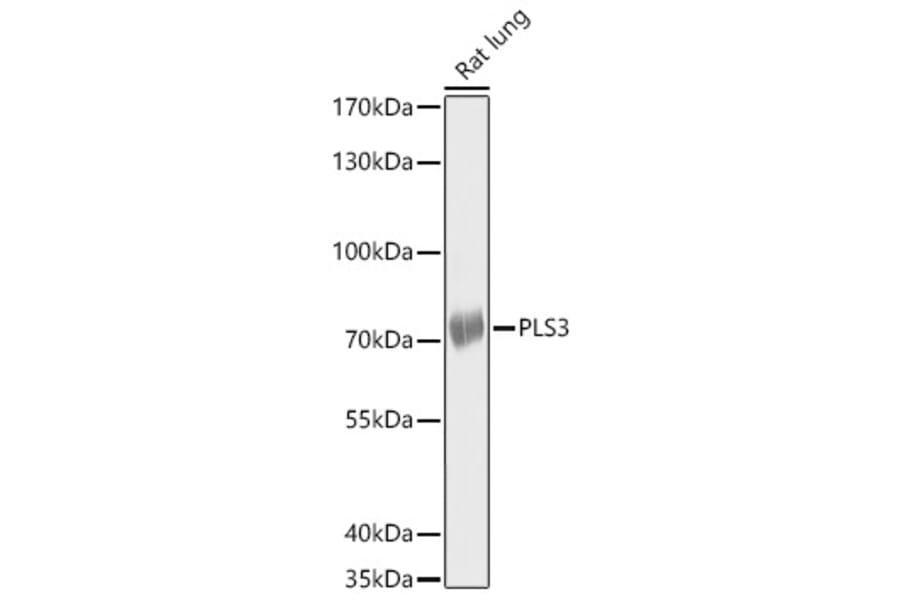 Western Blot - Anti-PLS3 Antibody (A14445) - Antibodies.com