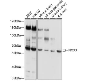 Western Blot - Anti-NOX3 Antibody (A14446) - Antibodies.com