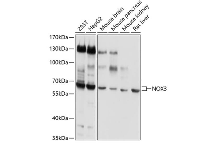 Western Blot - Anti-NOX3 Antibody (A14446) - Antibodies.com