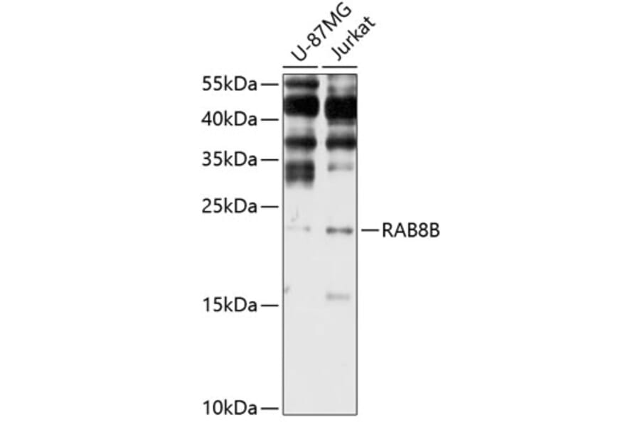 Western Blot - Anti-RAB8B Antibody (A3678) - Antibodies.com