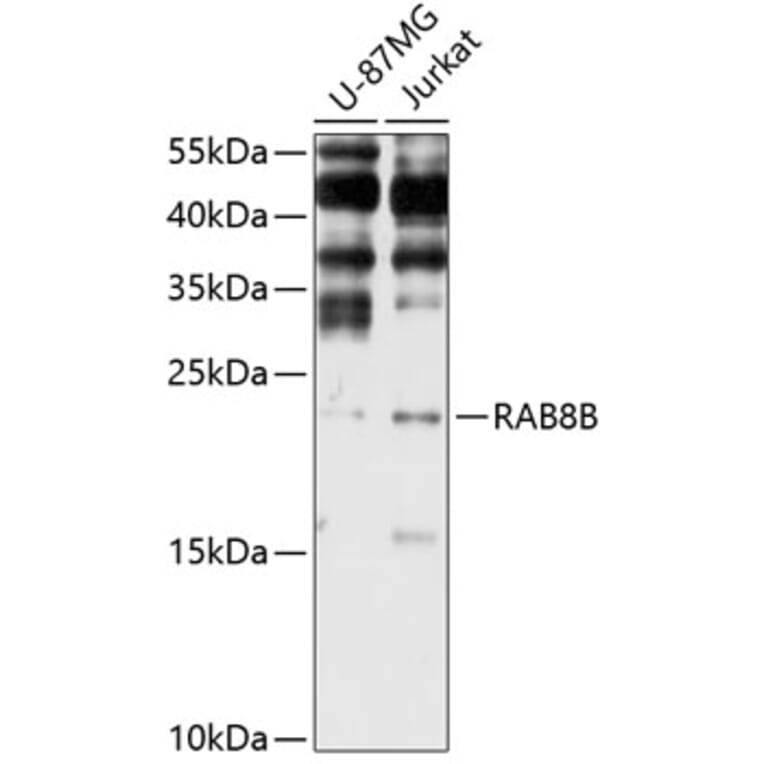 Western Blot - Anti-RAB8B Antibody (A3678) - Antibodies.com